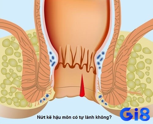 Thấy hậu môn chảy máu trong mơ lo âu và căng thẳng trong cuộc sống